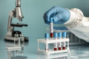 hand-with-protective-gloves-holding-blood-samples-covid-test